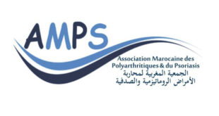 Casa :Vers le lancement des ateliers de formation de " malades experts" en rhumatologie
